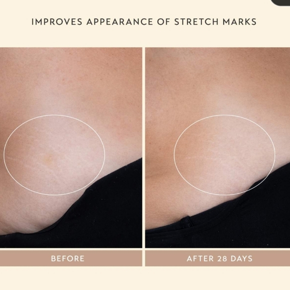 NIB SHANI DARDEN BODY REFORM TREATMENT SERUM - Picture 10 of 16